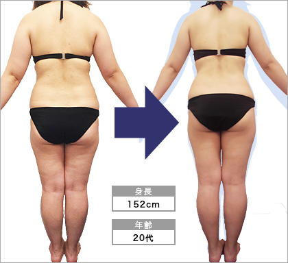 オリエンタルスタイル渋谷店S･I様3ヶ月でウエスト-11.0cm達成