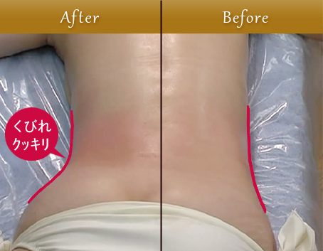 インドエステBefore・After